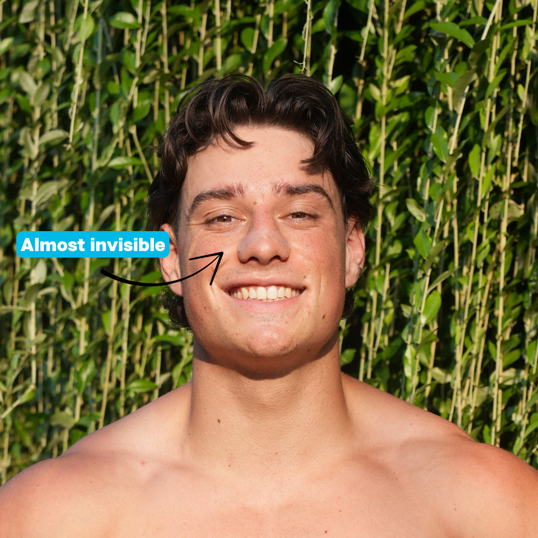 Sniffit® Transparante neusstrips